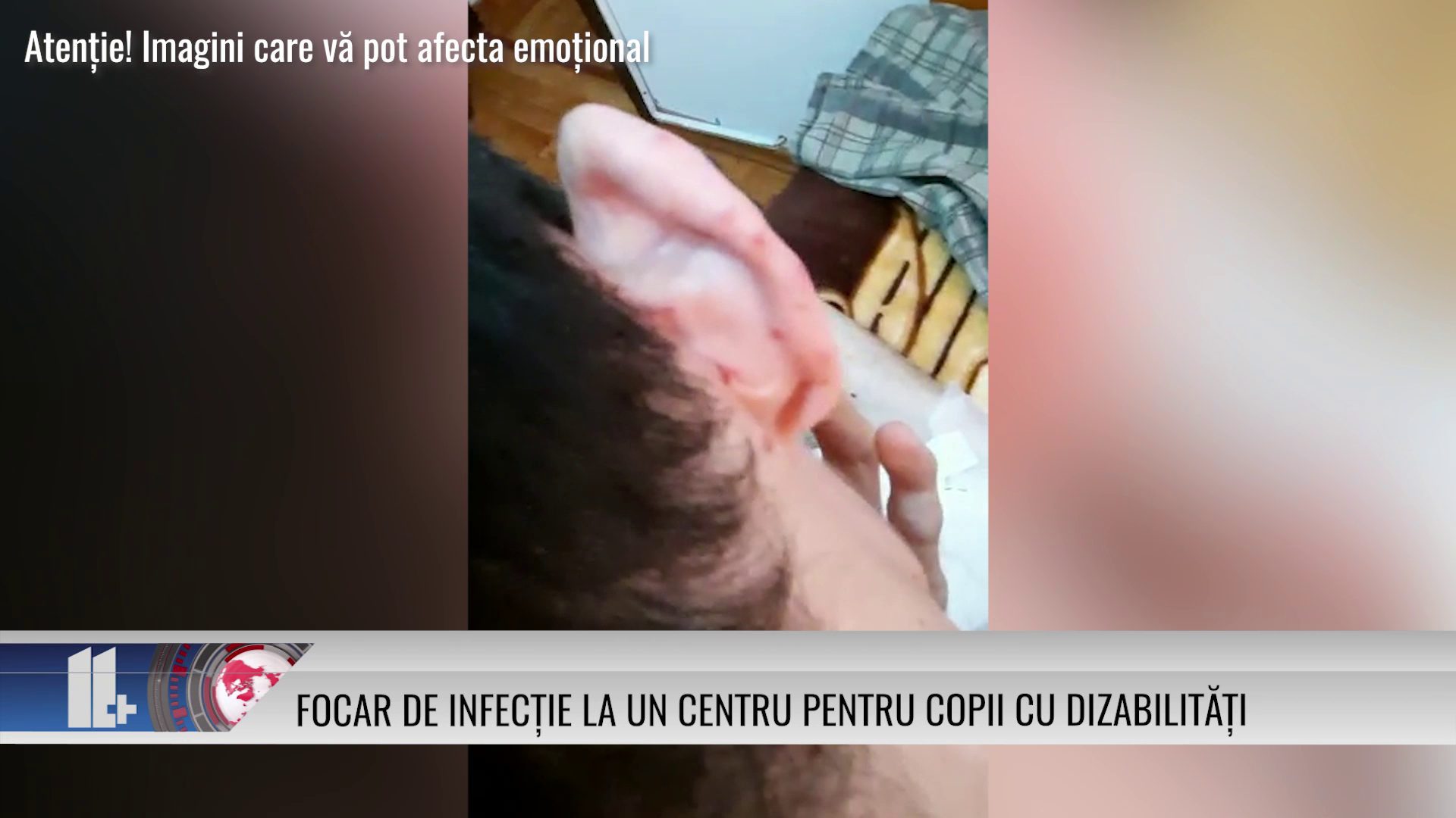 Focar de infecție la un centru pentru copii cu dizabilități