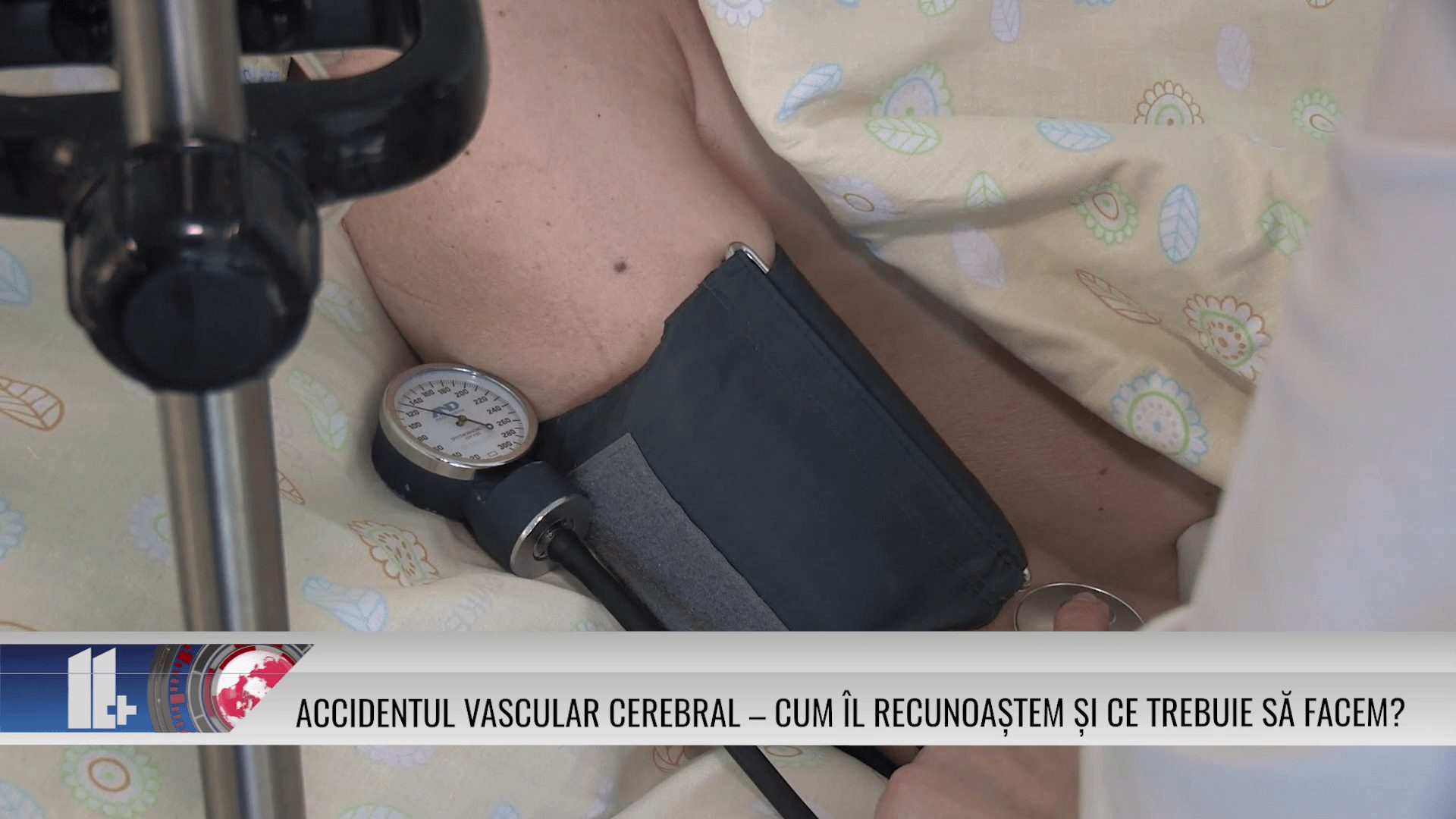 Accidentul vascular cerebral – cum îl recunoaștem și ce trebuie să facem?